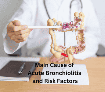 Main Cause of Acute Bronchiolitis and Risk Factors