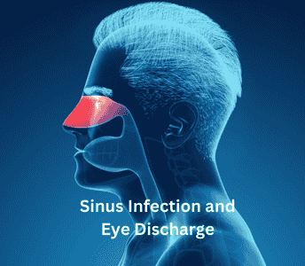 Sinus Infection and Eye Discharge